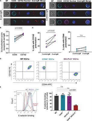 Acute Myeloid Leukemia Chemo-Resistance Is Mediated by E-selectin Receptor CD162 in Bone Marrow Niches